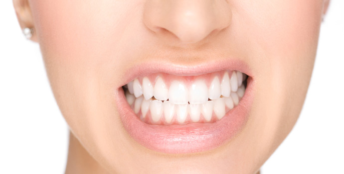 Bruxismo: como acabar com o ranger de dentes noturno