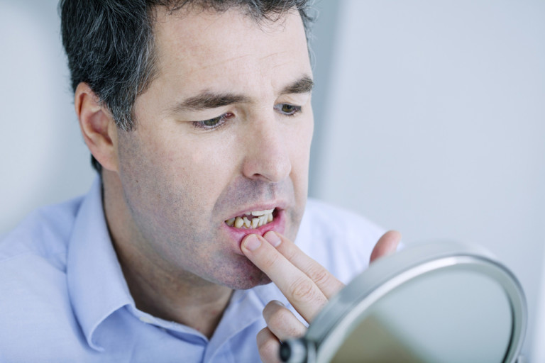 O que fazer quando o dente está quebrado