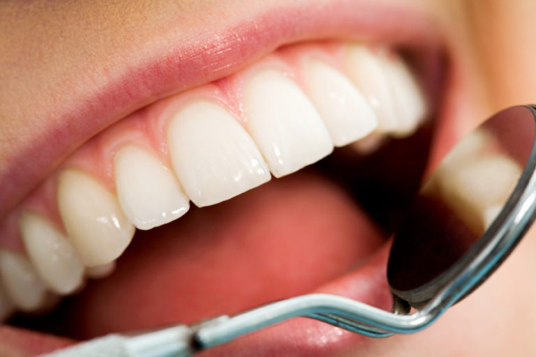 Saiba como evitar as 5 Doenças Dentárias mais Comuns