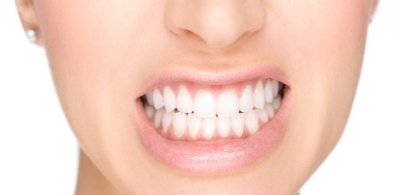 Bruxismo: como acabar com o ranger de dentes noturno