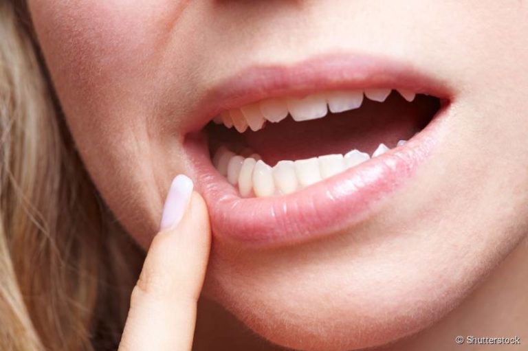 Dentes moles e separados podem indicar Doença