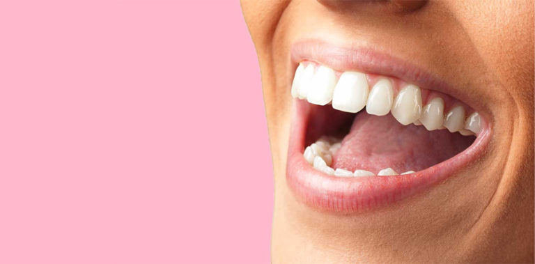 OS 5 PRINCIPAIS MOTIVOS DO AMARELAMENTO DOS DENTES