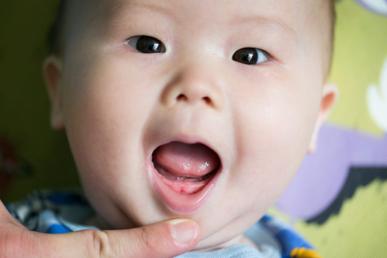 Higiene bucal do bebê deve começar antes dos dentes aparecerem. Veja dicas