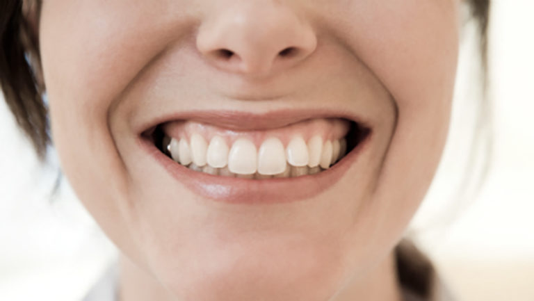 Descubra os problemas que dentes tortos e mal posicionados podem causar