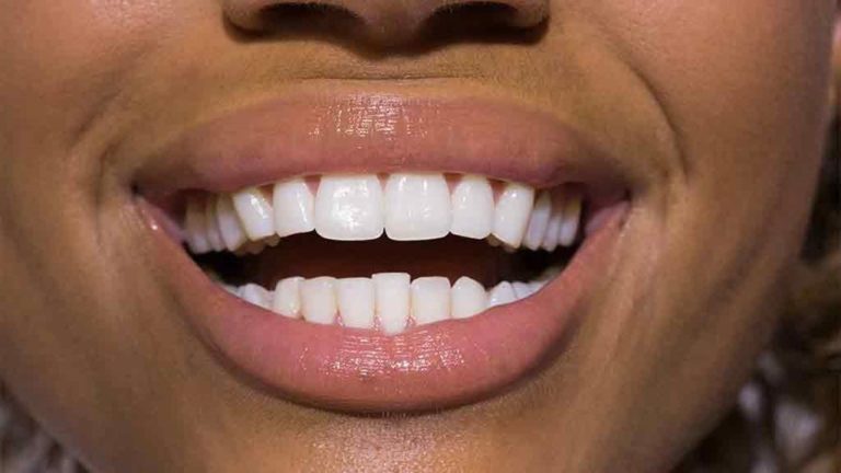 4 sinais que indicam a presença de uma doença periodontal