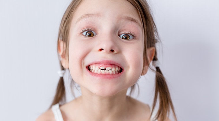 Bruxismo infantil: Causas, tratamentos e como lidar