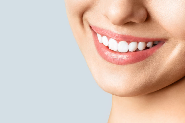 5 fake news sobre clareamento dental